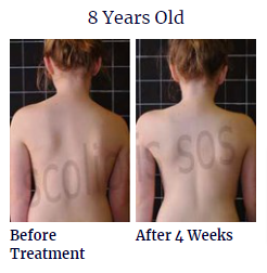 bslide4